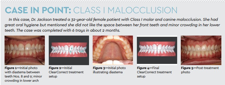 case in point class i malocclusion